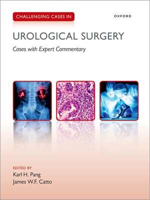 cover image of Challenging Cases in Urological Surgery
